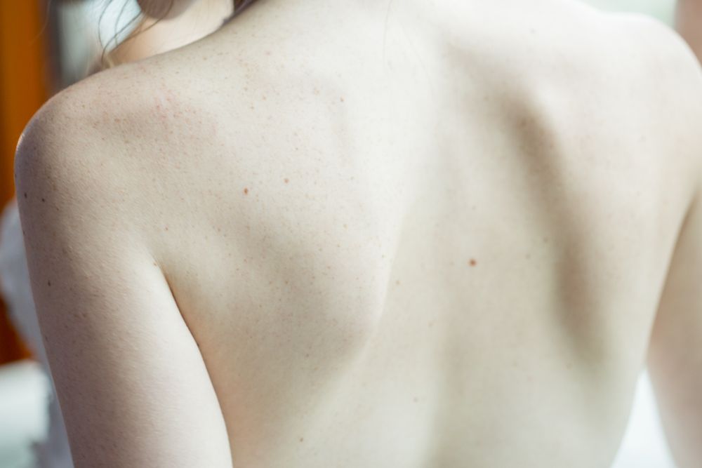 Ruecken und Schultern einer Frau mit glatter Haut